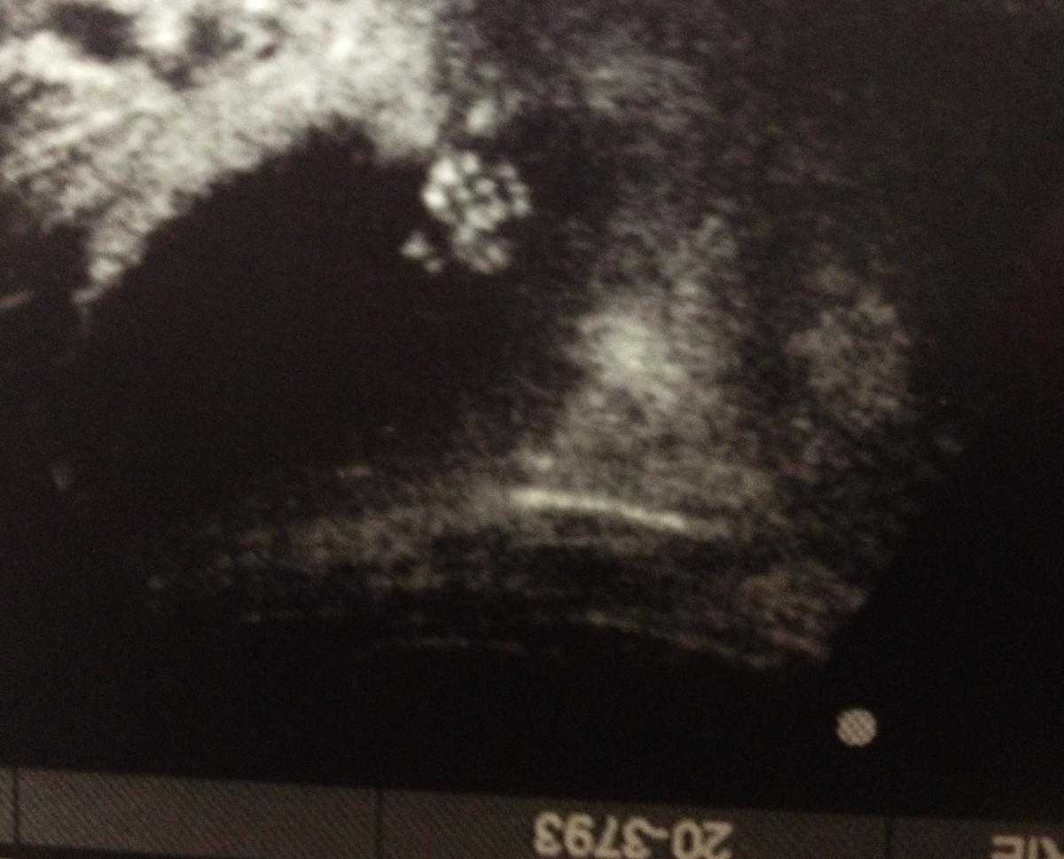 The First Ultrasound, WITH Pictures!!!!